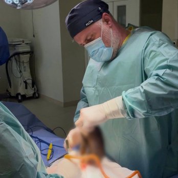 Видалення клубка волосся з шлунка дівчини