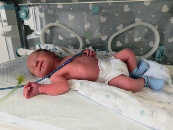 Львівські лікарі 3 місяці зберігали вагітність після відходження вод у матері – 03