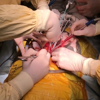 Львівські лікарі за добу пересадили нирки двом пацієнтам – 05