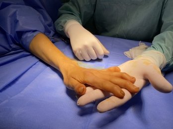 Усе життя ховала руки від чужих очей: львівські лікарі прооперували жінку із рідкісною патологією – 04