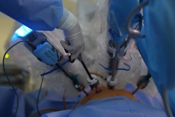 У Львові лікарі вперше самостійно видалили матку за допомогою робота – 03