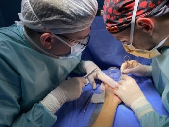 Усе життя ховала руки від чужих очей: львівські лікарі прооперували жінку із рідкісною патологією – 05