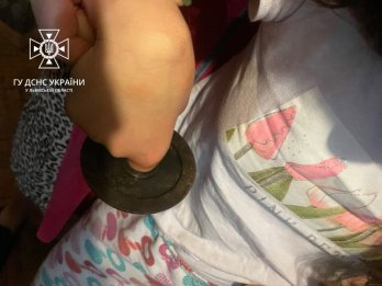 У Львові палець дитини застряг у кільці від гирі, довелось викликати рятувальників (фото) – 01