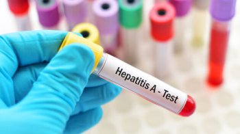 На Львівщині зафіксували спалах Гепатиту А