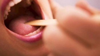 На Львівщині зафіксували три випадки захворювання на дифтерію