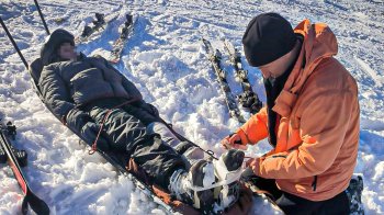 Рятувальники Львівщини допомогли травмованому 11-річному лижнику