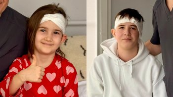 Львівські медики відновили можливість чути обома вухами двом дітям