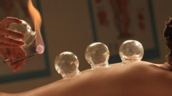 Масажистка з Івано-Франківська під час сеансу спалила клієнтку