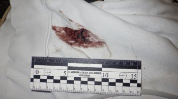 Підлітки спершу вживали з чоловіком алкоголь, а потім побили його й винесли на вулицю, фото поліції