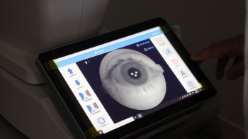 Львів’янам пропонують безкоштовний ШІ-сервіс для скринінгу зору