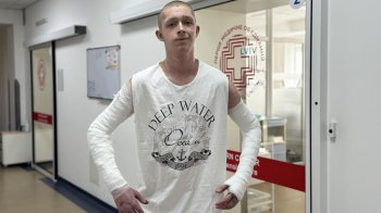 У Львові лікарі пересадили свинячу шкіру 19-річному хлопцю з опіками