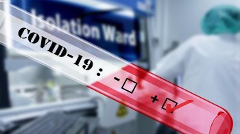 На Львівщині передбачили понад 57 млн для боротьби з ковідом