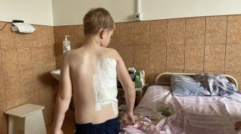 Пережив кому і вісім операцій: львівські лікарі врятували 11-річного хлопця з Харкова