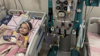 Медики у Львові врятували 7-річну дівчинку з рідкісним захворюванням нирок