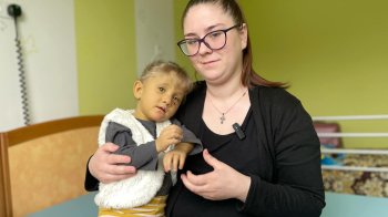 У Львові вперше в Україні лікуватимуть дітей із рідкісним захворюванням — синдромом Алажиля