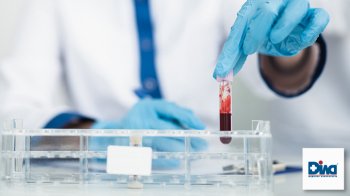 Як правильно підготуватися до здачі аналізів крові?