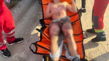 У Львові 13-річний хлопець робив селфі на вагоні поїзда і його уразило струмом