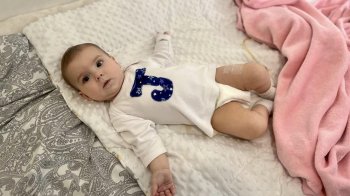 Фото семимісячної Олівії після операції