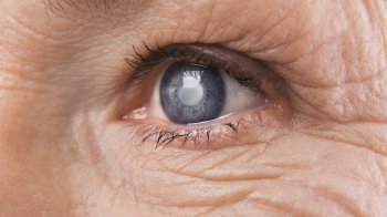Як запобігти катаракті: ефективні методи