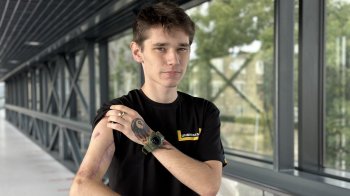 Львівські хірурги врятували руку 21-річного бійця після року полону