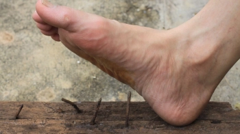 До лікарні у Львові госпіталізували ще одного чоловіка з правцем