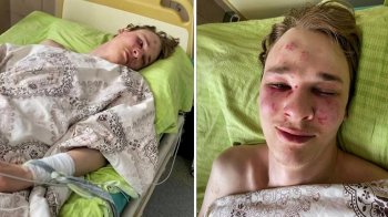 Фото потерпілого