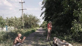 Багатьом пораненим унаслідок вчорашнього обстрілу Лисичанська довелося ампутувати кінцівки