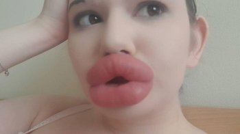 Хоче бути схожою на живу ляльку Bratz: дівчина зробила вже 32 пластичні операції й планує нову