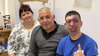 У Львові прооперували 16-річного хлопця з Харкова із рідкісним вродженим синдромом