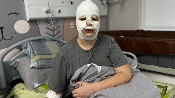 Трьох дітей госпіталізували до львівської лікарні через небезпечний челендж із Тік-Току