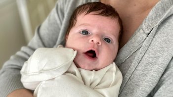 Львівські лікарі врятували 7-денну дівчинку з переміщенням внутрішніх органів