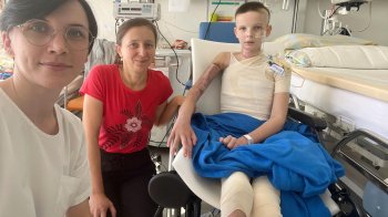 У Львові лікарі прооперували дівчинку, яка обпекла чверть тіла під час ігор біля багаття