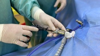 Лапароскопічна 3D-операція