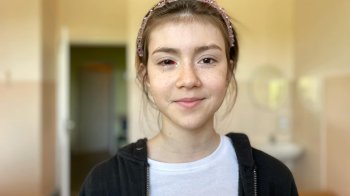 Львівські офтальмологи врятували око 11-річної дівчинки