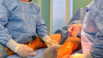 Варикоз повернувся через 22 роки: львівські медики прооперували пацієнта з Енергодара