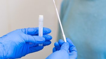 У Львові жінок запрошують на безплатний скринінг на вірус папіломи людини