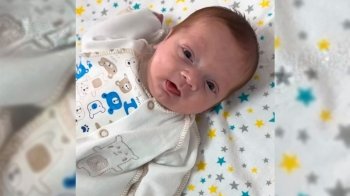 У Львові виходили хлопчика, який народився з вагою 580 грамів: це найменший пацієнт в історії пологового