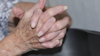 У Буську ледь не згоріла 81-річна жінка, яка спалювала сухостій на городі