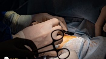 З початку війни львівські медики провели вісім трансплантацій органів