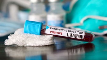 Коронавірус: 1 липня, актуальна статистика