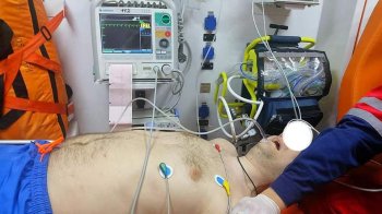 Львівські медики врятували молодого чоловіка, який пережив клінічну смерть