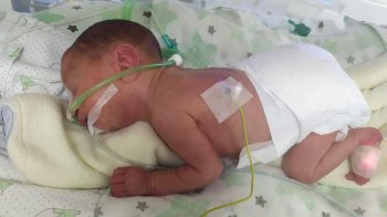 Львівські лікарі виходили хлопчика, народженого з вагою 960 грамів