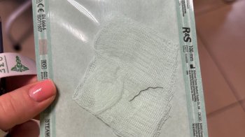 У Львові врятували зір 17-річному хлопцю, якому в око влетів дріт від болгарки