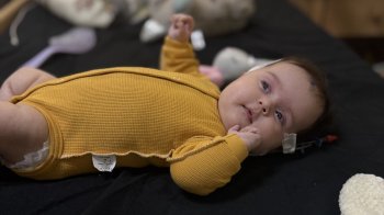 У Львові медики видалили небезпечну пухлину мозку двомісячній дівчинці