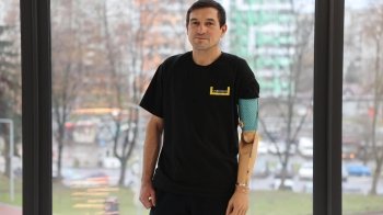 Аби врятувати життя, руку довелося ампутувати: у Львові встановили протез воїну з Маріуполя