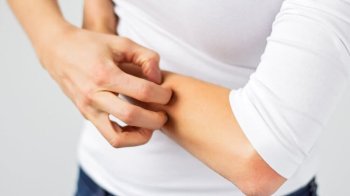 На Львівщині вдвічі зросла кількість хворих на коросту 