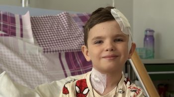 У Львові шестирічному хлопчику з епілепсією провели складну операцію на мозку