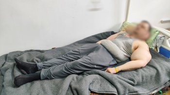 Один із 300 випадків у світі: у львівській спецлікарні рятують засудженого з рідкісною хворобою Маделунга