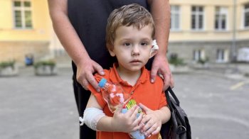 Гній у вусі зруйнував скроневу кістку: львівські хірурги врятували трирічного хлопчика