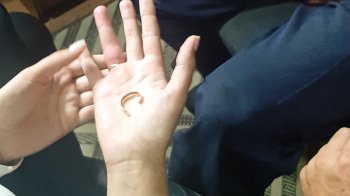 У Львові рятувальники вивільнили палець жінки: він застряг в обручці